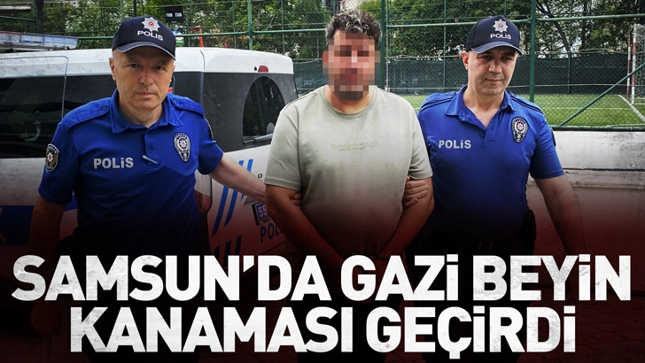 Samsun’da kuzeninin itip düşürdüğü gazi, beyin kanaması geçirdi