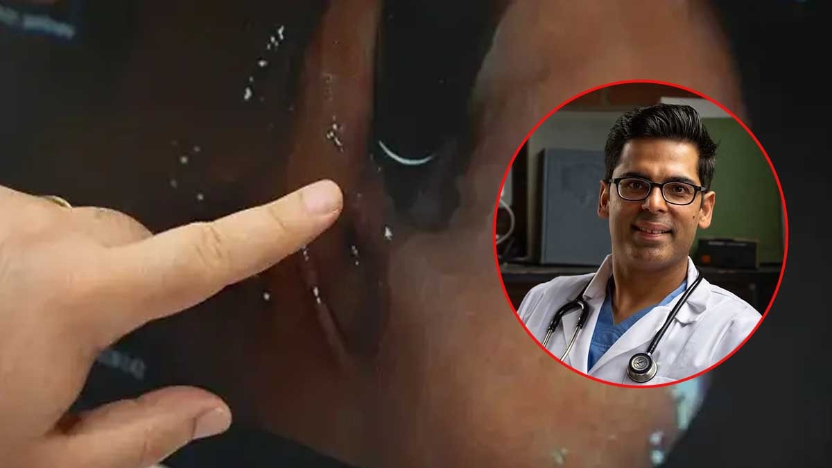 Harvardlı Doktor 'detoksa gerek yok' dedi, bağırsakları genç tutmanın 4 formülünü verdi